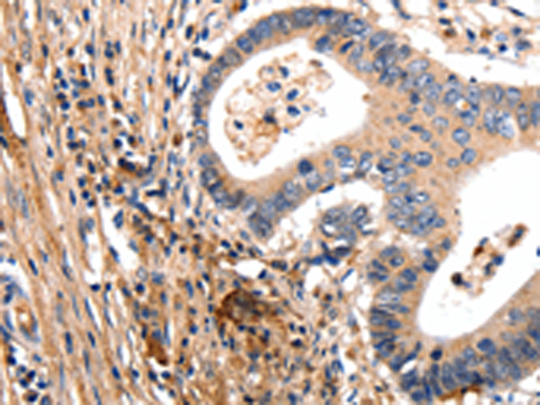 Rabbit Polyclonal Antibody to GSK3A