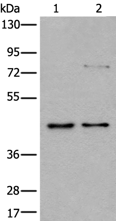 Rabbit Polyclonal Antibody to GSK3B