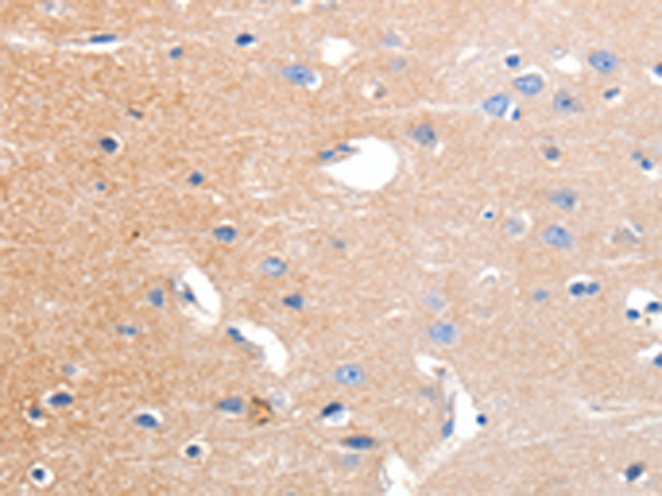 Rabbit Polyclonal Antibody to KCNH3