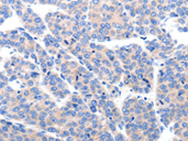Rabbit Polyclonal Antibody to KCNH8