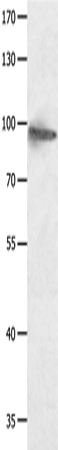 Rabbit Polyclonal Antibody to HCN1