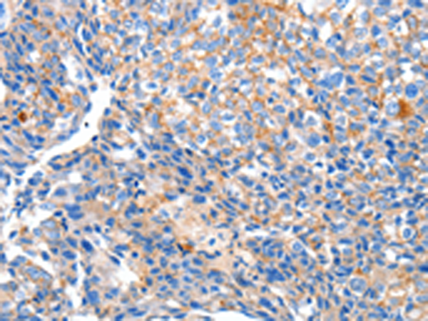 Rabbit Polyclonal Antibody to HCN2