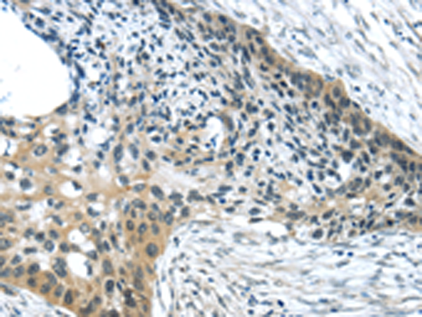 Rabbit Polyclonal Antibody to HCN4