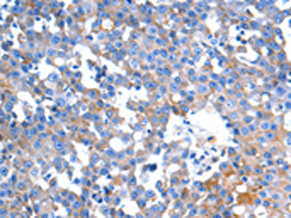 Rabbit Polyclonal Antibody to HINT2