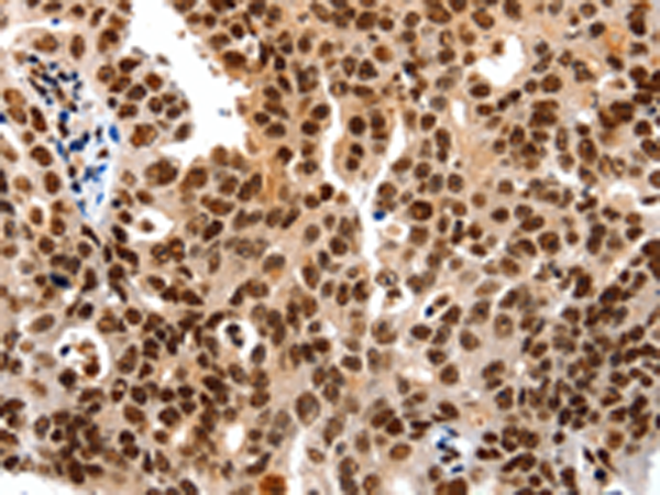 Rabbit Polyclonal Antibody to HDAC2