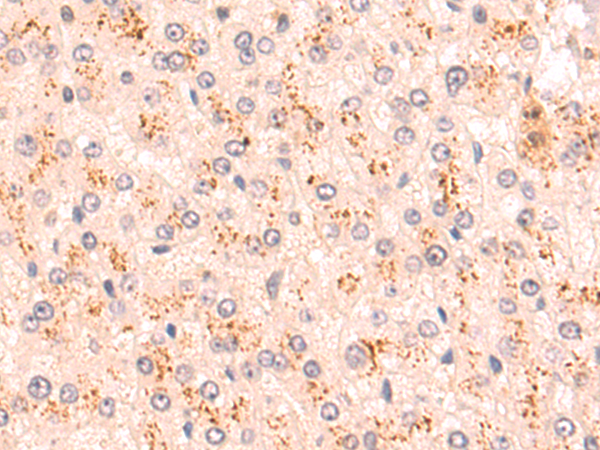 Rabbit Polyclonal Antibody to HDAC4