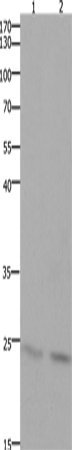 Rabbit Polyclonal Antibody to HMGB3