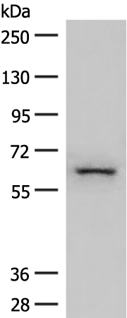 Rabbit Polyclonal Antibody to HNF1A
