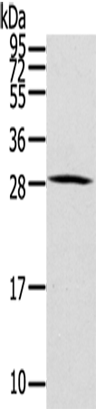 Rabbit Polyclonal Antibody to HOXC8