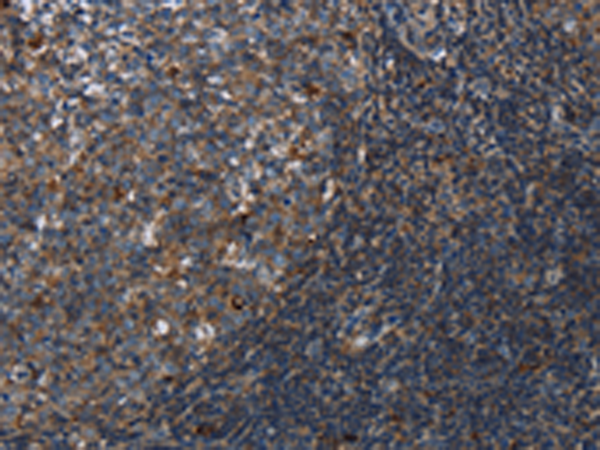 Rabbit Polyclonal Antibody to LAIR2