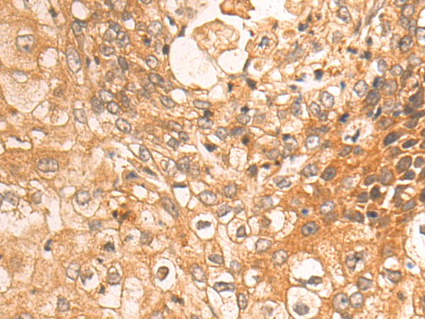 Rabbit Polyclonal Antibody to LEPR