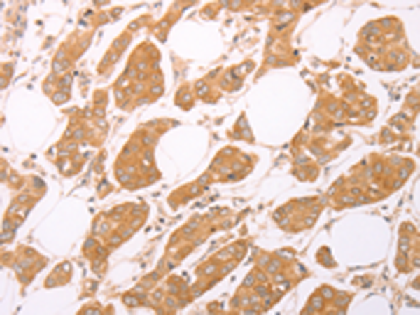 Rabbit Polyclonal Antibody to LEPR(S/L)