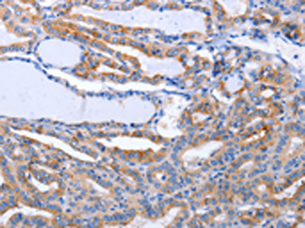 Rabbit Polyclonal Antibody to LIF