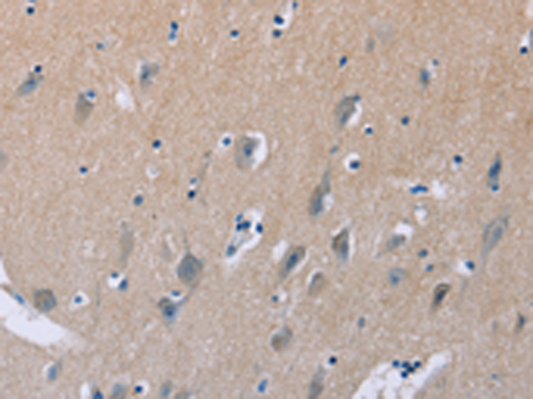 Rabbit Polyclonal Antibody to LIFR