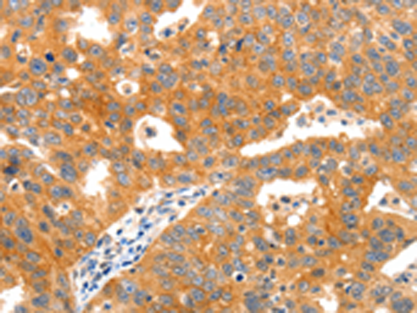 Rabbit Polyclonal Antibody to PAFAH1B1