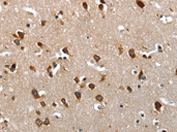 Rabbit Polyclonal Antibody to LAMA1