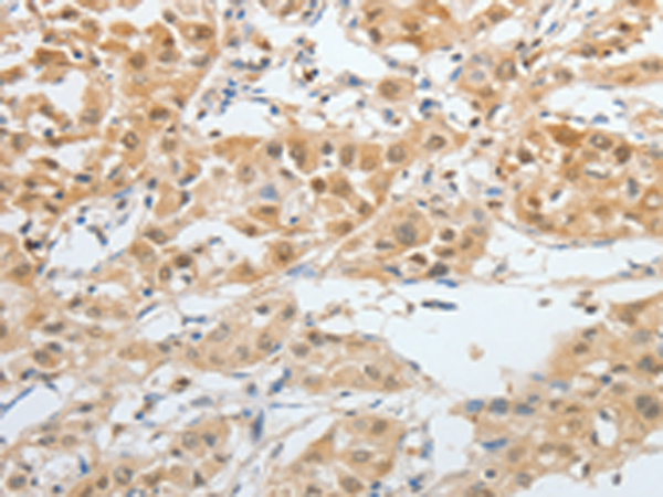 Rabbit Polyclonal Antibody to BPIFB2