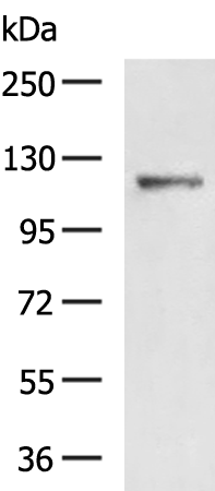 Rabbit Polyclonal Antibody to LRIG1