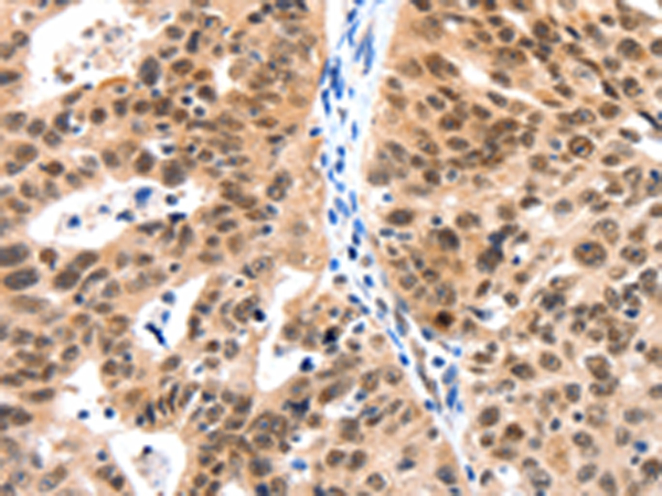 Rabbit Polyclonal Antibody to LRP5