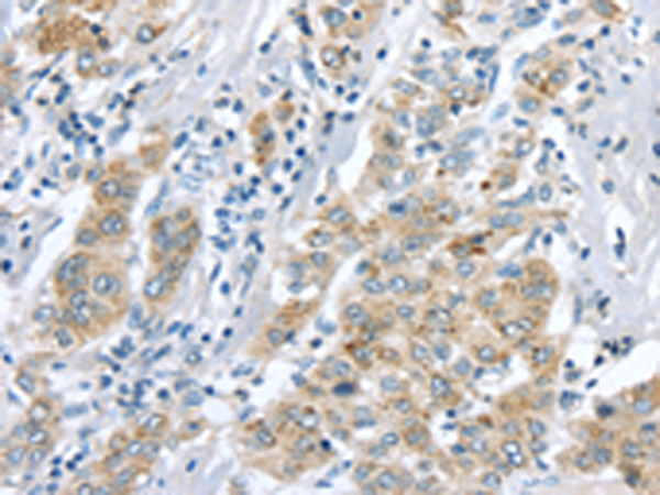 Rabbit Polyclonal Antibody to LRP6
