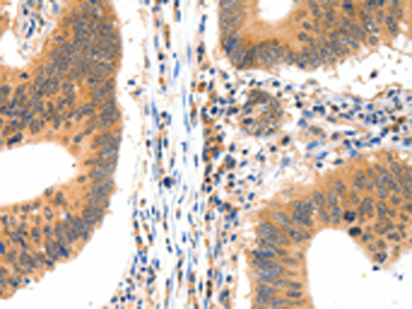 Rabbit Polyclonal Antibody to LRPPRC