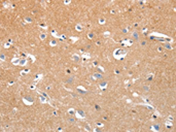 Rabbit Polyclonal Antibody to LRP3