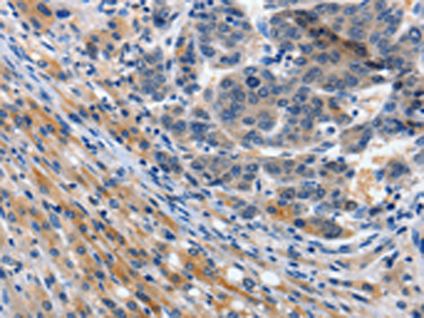Rabbit Polyclonal Antibody to ITGAX