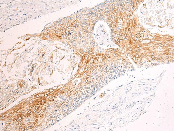 Rabbit Polyclonal Antibody to ITGAM