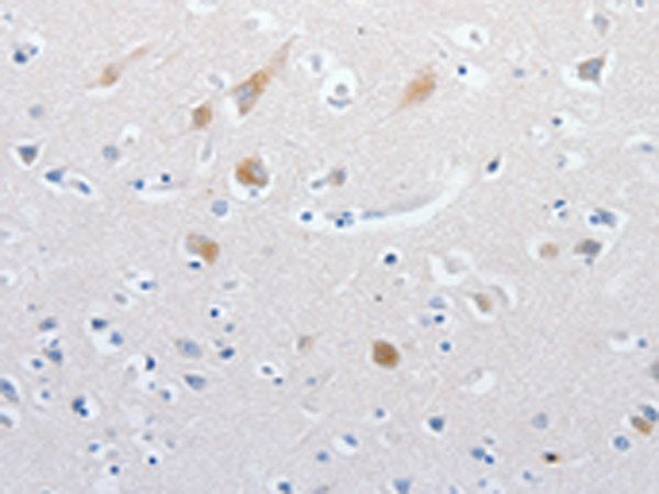 Rabbit Polyclonal Antibody to MATN1