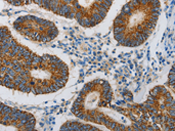 Rabbit Polyclonal Antibody to MAP3K5