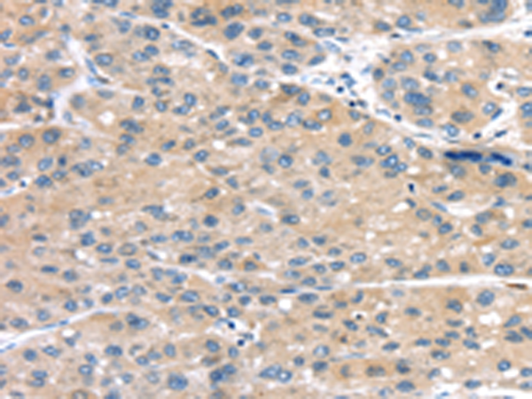 Rabbit Polyclonal Antibody to MASP2