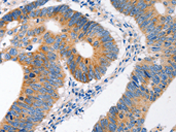 Rabbit Polyclonal Antibody to MC1R