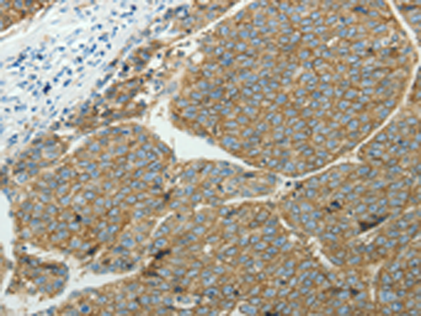 Rabbit Polyclonal Antibody to SLC16A1