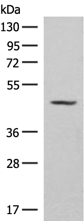 Rabbit Polyclonal Antibody to SLC16A14