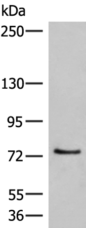 Rabbit Polyclonal Antibody to MCMBP