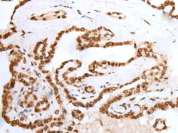 Rabbit Polyclonal Antibody to PIF1