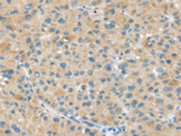 Rabbit Polyclonal Antibody to ABCC2