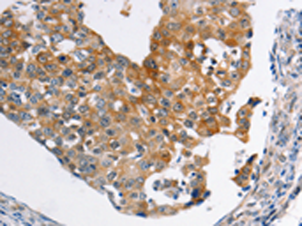 Rabbit Polyclonal Antibody to ABCC3