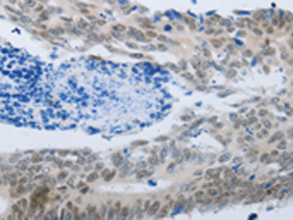 Rabbit Polyclonal Antibody to MMP21