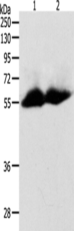 Rabbit Polyclonal Antibody to MMP11