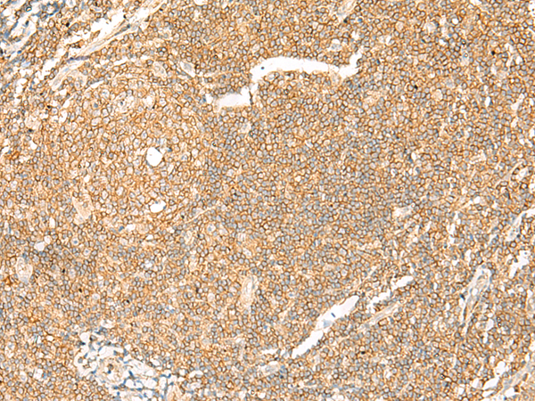 Rabbit Polyclonal Antibody to MMP19