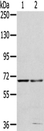 Rabbit Polyclonal Antibody to MMP24