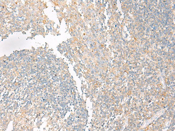 Rabbit Polyclonal Antibody to MMP26