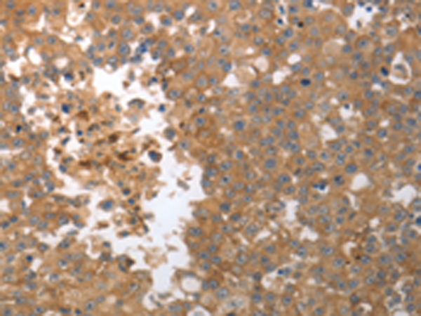 Rabbit Polyclonal Antibody to MMP27
