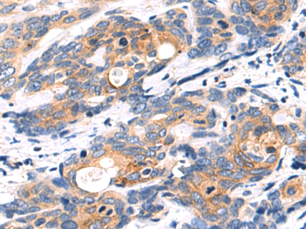 Rabbit Polyclonal Antibody to MUC5AC