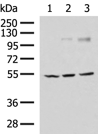 Rabbit Polyclonal Antibody to CHRNA1