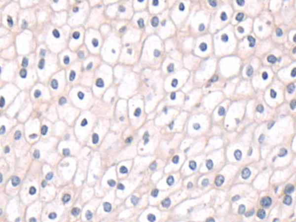Rabbit Polyclonal Antibody to CHRNA10
