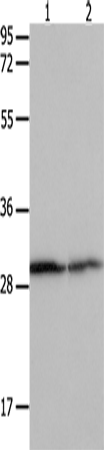 Rabbit Polyclonal Antibody to YWHAB