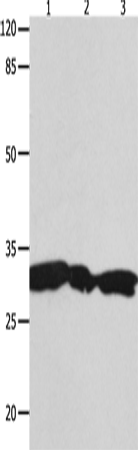 Rabbit Polyclonal Antibody to YWHAG