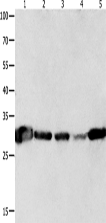 Rabbit Polyclonal Antibody to YWHAQ
